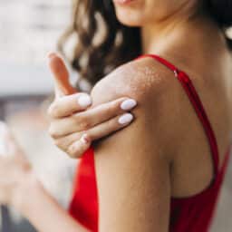 Woman experiencing dermatitis touching her shoulder